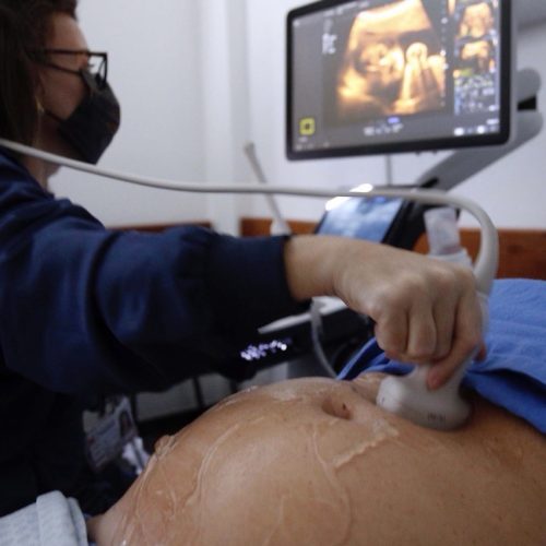 Paraná é segundo estado com maior redução da gravidez na adolescência