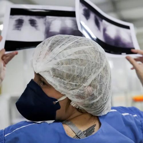 Brasil deve ter 781 mil novos casos de câncer por ano até 2028