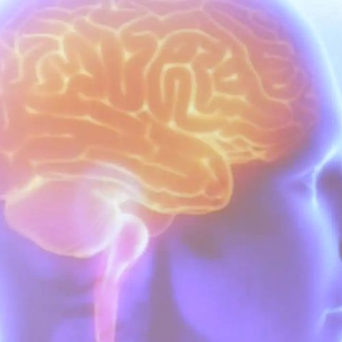 AVC mata uma pessoa a cada seis minutos no Brasil