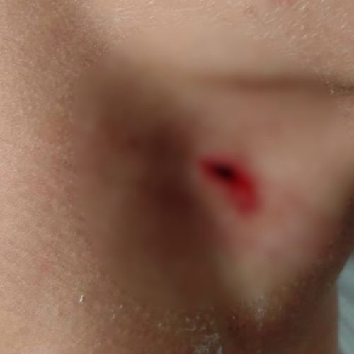 Adolescente é apreendido após atacar colega com caneta em escola&nbsp;na região